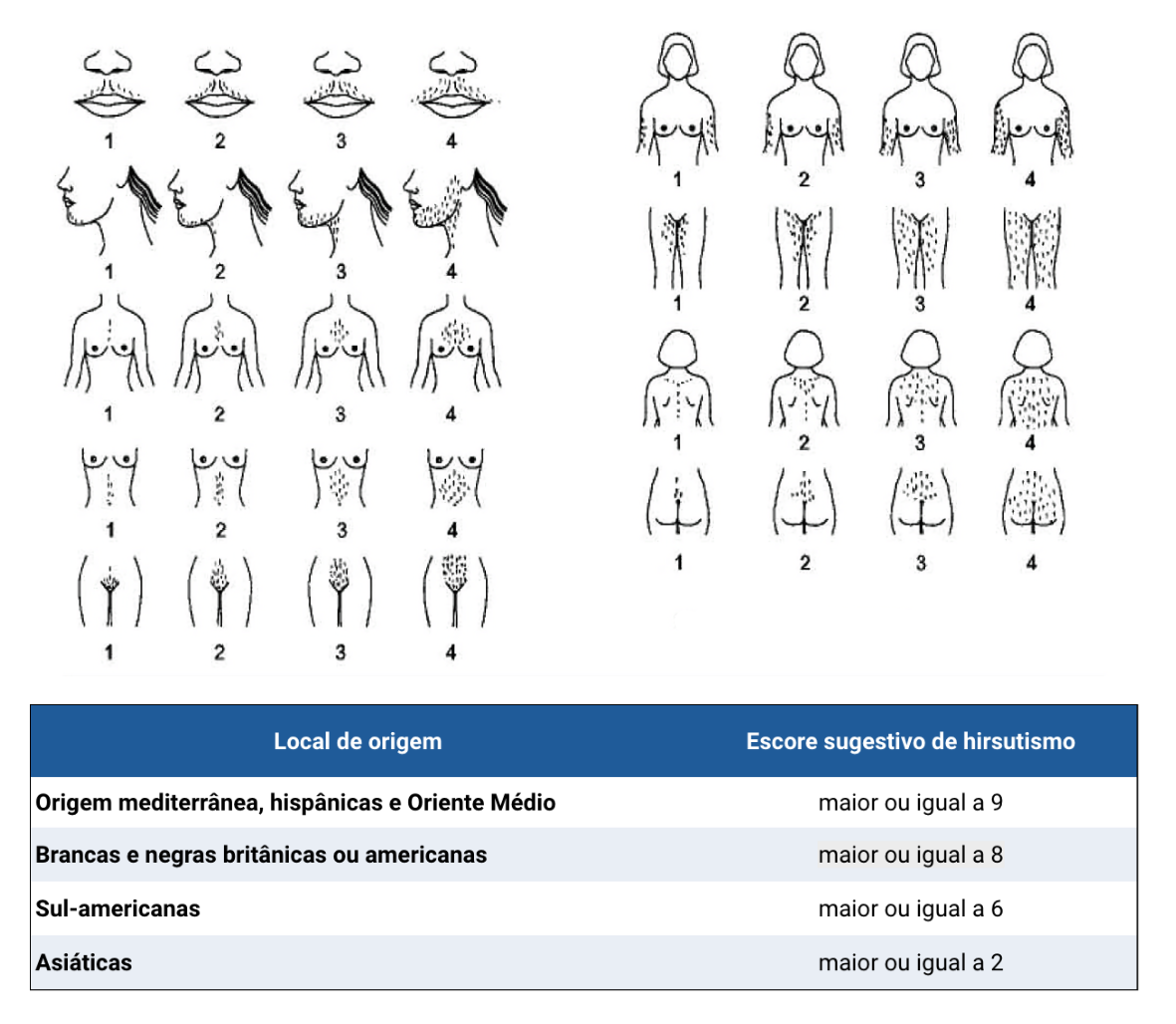 box-semio-escore-hirsutismo