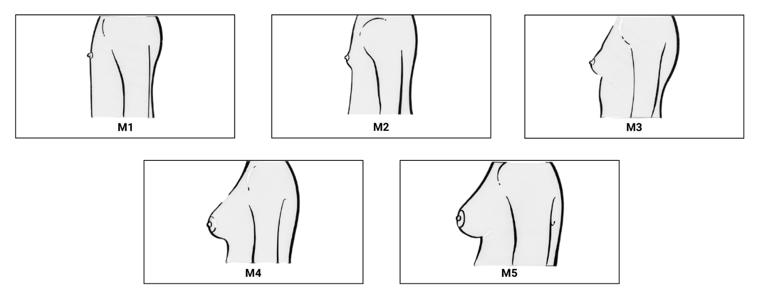 fig-semio-estadiamento-puberal-mamas