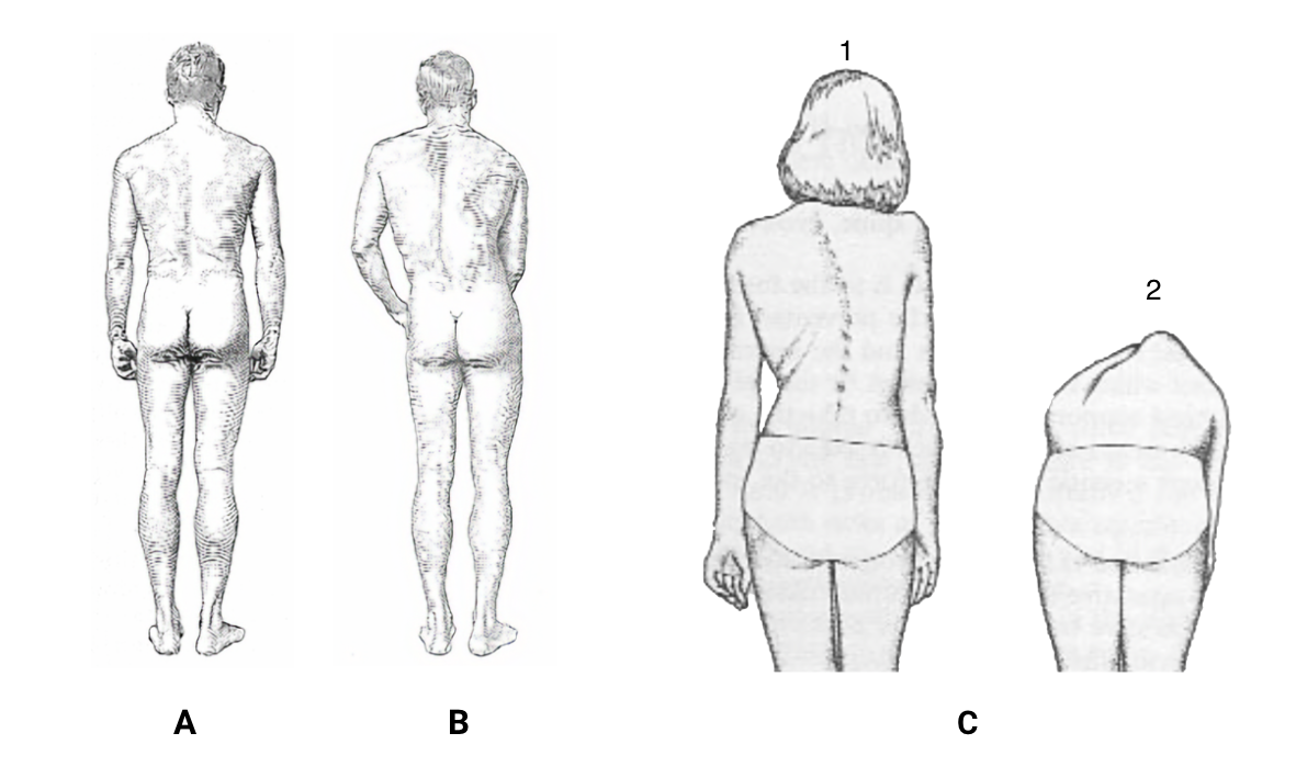 fig-semio-exame-coluna