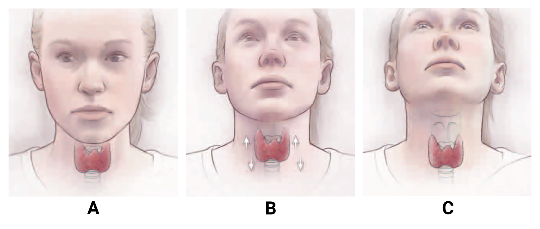 fig-semio-inspecao-tireoide