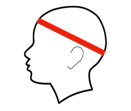 fig-semio-perimetro-cefalico