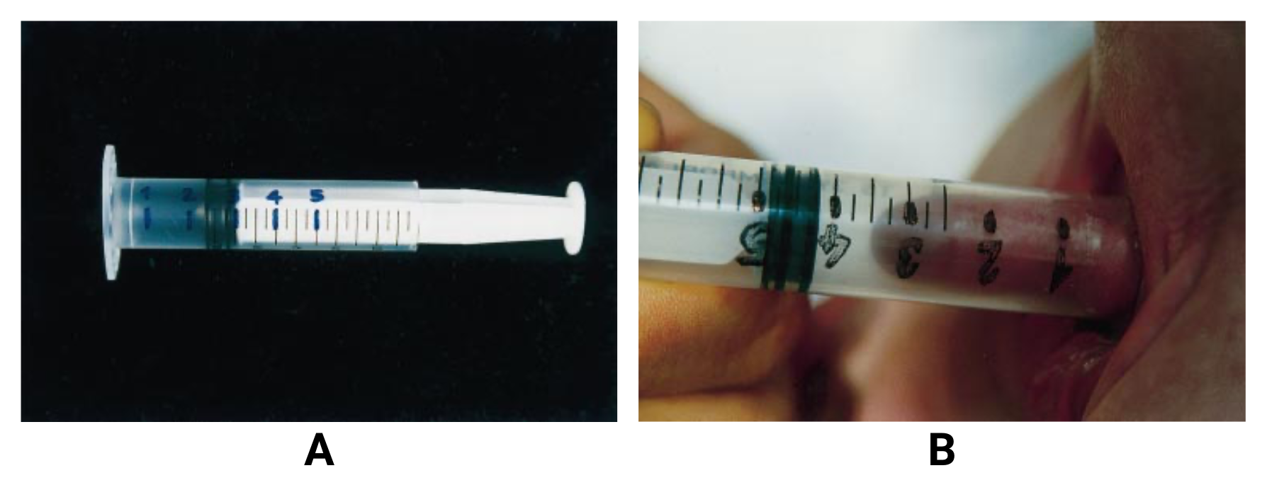 fig-semio-seringa-tamanho-peniano